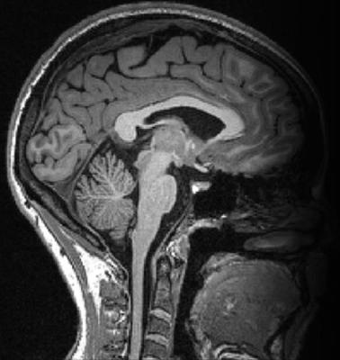 TSD Imaging processing pipeline